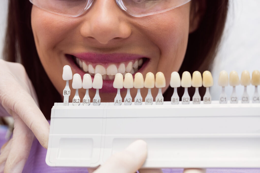 Are Veneers a Permanent Solution for Your Smile?