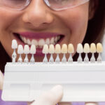 Are Veneers a Permanent Solution for Your Smile?